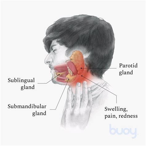 Salivary Glands & Salivary Problems: Location, Causes,